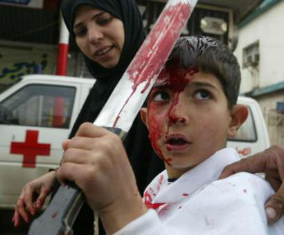 Even little Muslims can join in- slicing and dicing themselves fortheir RELIGION. Even little Muslims can join in- slicing and dicing themselves fortheir RELIGION.